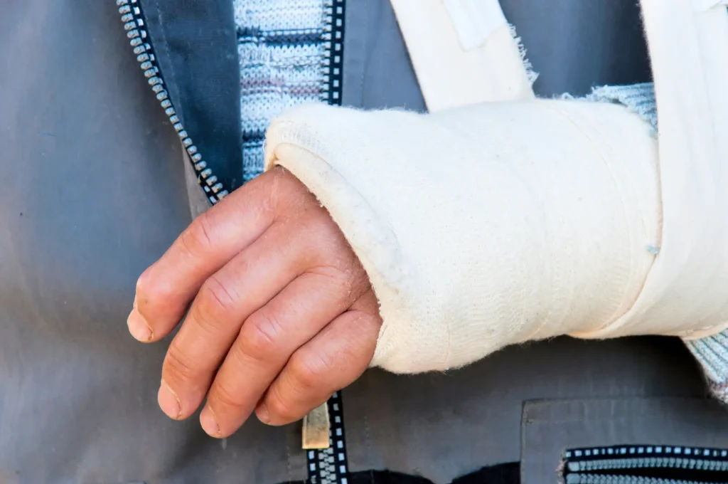 Man's arm in cast and sling